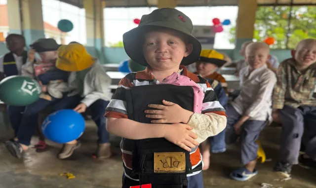 Türk STK’ler Tanzanya’daki albino çocuklara bayram sevinci yaşattı Türk STK’ler Tanzanya’daki albino çocuklara bayram sevinci yaşattı
